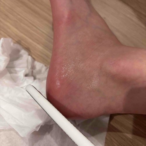 フットケアセット/BAREN/その他キットセットを使ったクチコミ(3枚目)