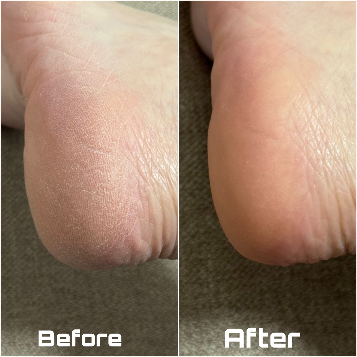 フットケアセット/BAREN/その他キットセットを使ったクチコミ(3枚目)