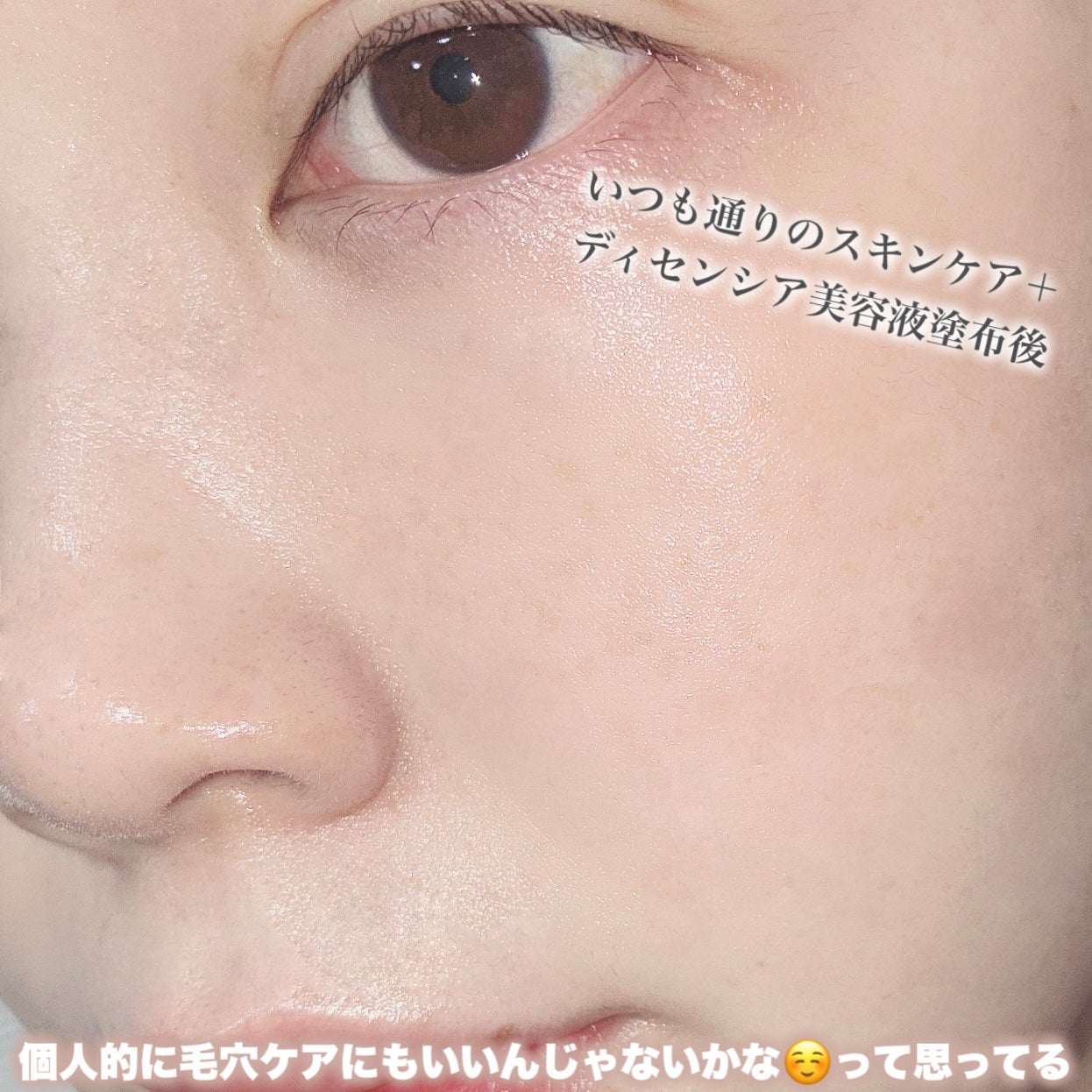 リンクル O/L コンセントレート/DECENCIA/美容液を使ったクチコミ(4枚目)