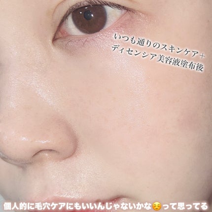 リンクル O/L コンセントレート/DECENCIA/美容液を使ったクチコミ(4枚目)