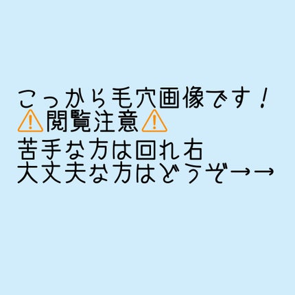 トラブルパッチマスク/EIOM/その他スキンケアを使ったクチコミ(3枚目)