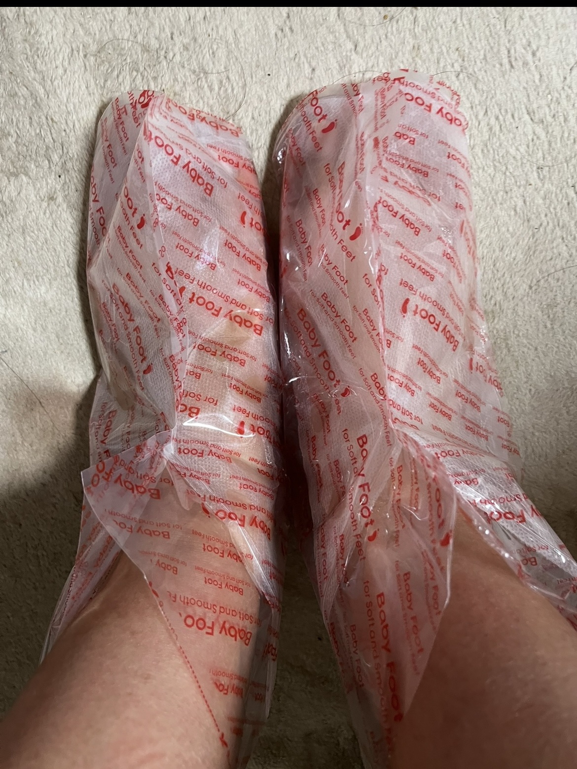 イージーパックDP60分タイプ/ベビーフット/レッグ・フットケアを使ったクチコミ（3枚目）