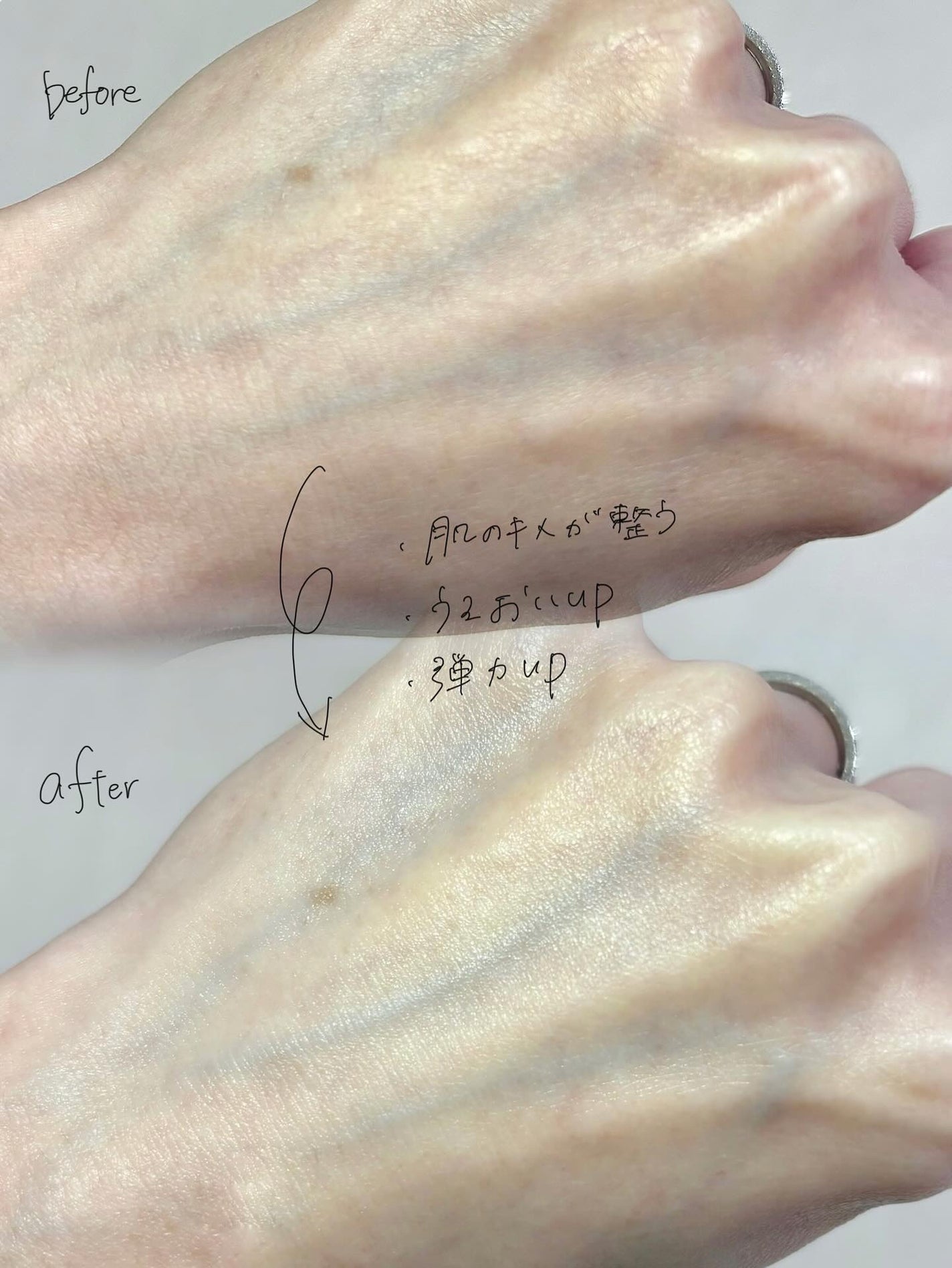 センテラフィト&5ペプチド コンセントレイトクリーム/haruharu wonder/フェイスクリームを使ったクチコミ(4枚目)