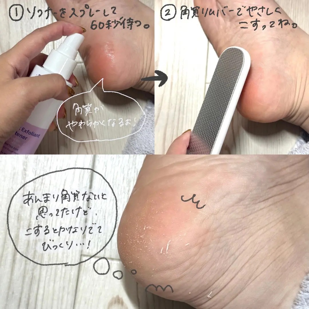 フットケアセット/BAREN/その他キットセットを使ったクチコミ（2枚目）