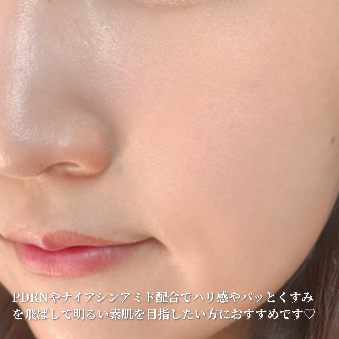 ダーマアンサーPDRNトナー/CNP Laboratory/化粧水を使ったクチコミ(3枚目)