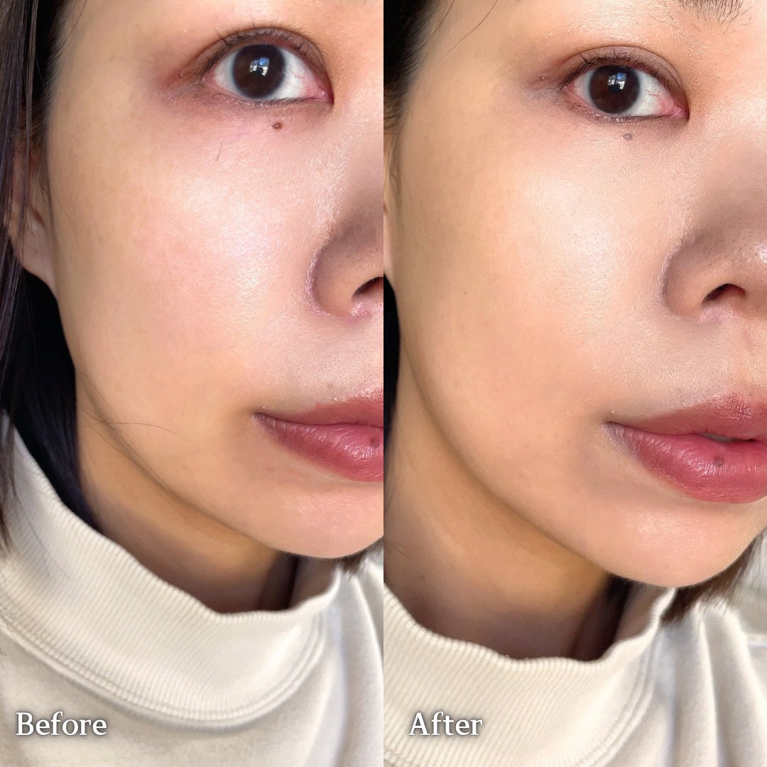 ディオールスキン フォーエヴァー スキン コレクト コンシーラー/Dior/リキッドコンシーラーを使ったクチコミ(6枚目)