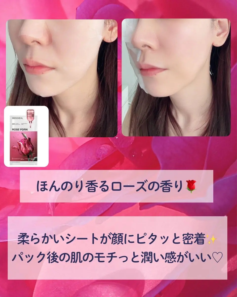 ローゼPDRNエッセンシャルマスクヘルシーグロウ 4枚入り/MEDIHEAL/シートマスク・パックを使ったクチコミ（3枚目）