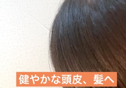 グローターンヘアアンプル/リリーイブ/頭皮ローションを使ったクチコミ(4枚目)