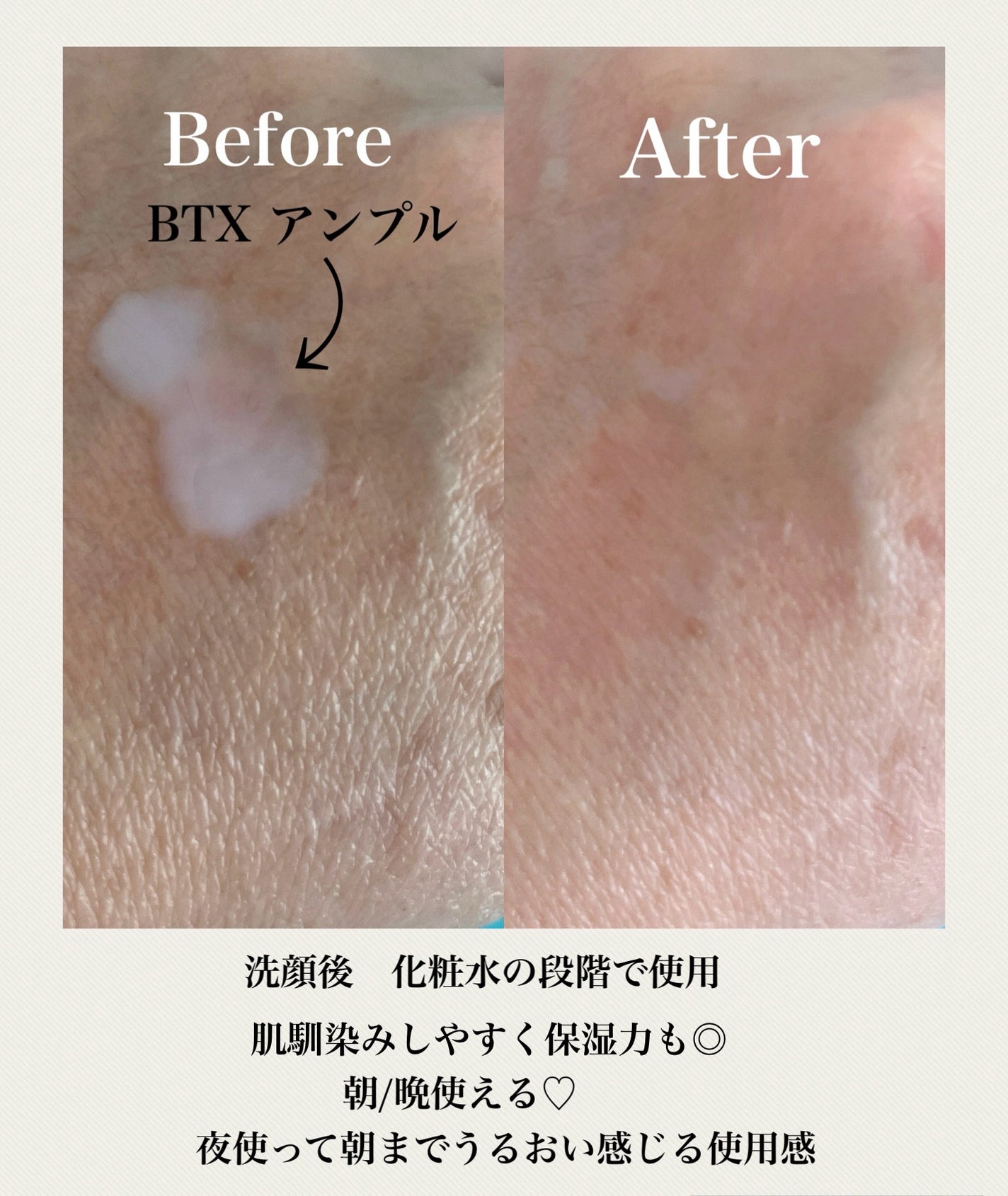 BTXクリームアンプル/MAXCLINIC/フェイスクリームを使ったクチコミ(2枚目)