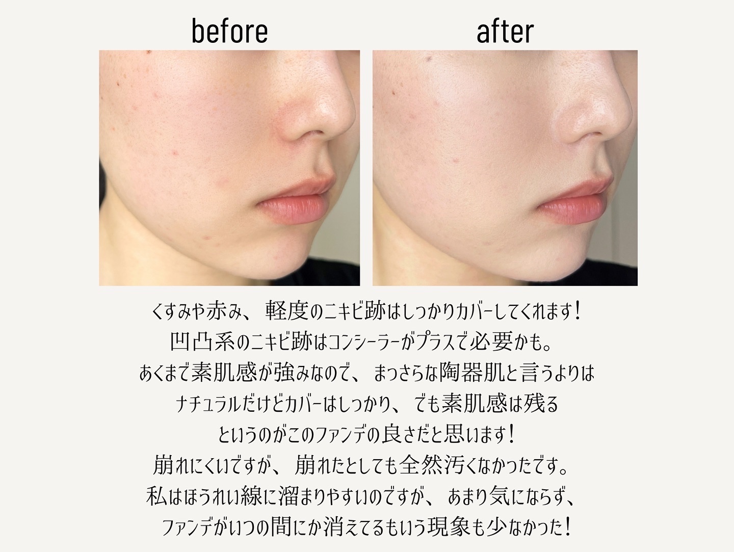 スキンレイヤーフィットファンデーション/ABOUT TONE/リキッドファンデーションを使ったクチコミ（3枚目）