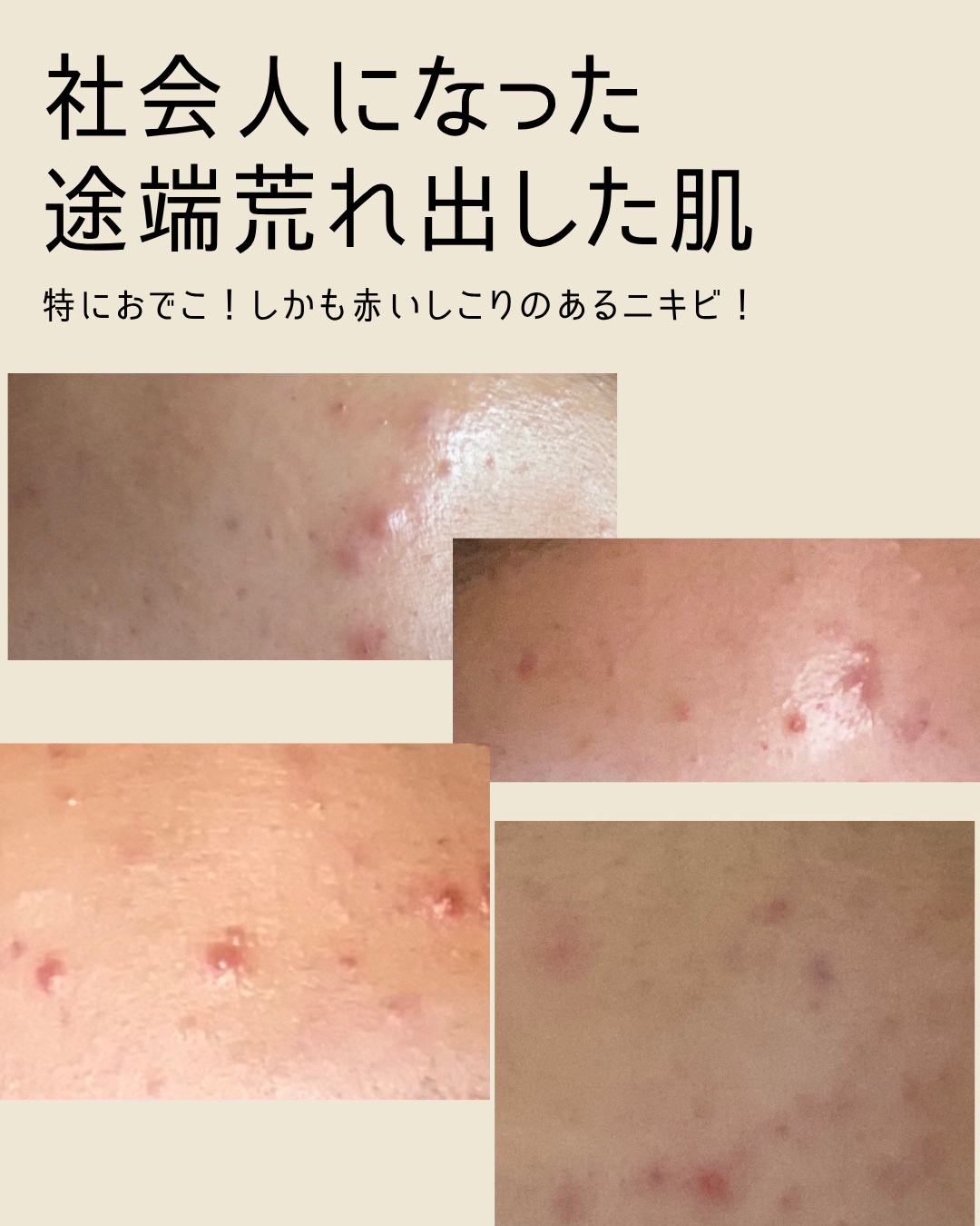 マンデリック インテンシブ 18%セラム/DR.WU/美容液を使ったクチコミ（2枚目）