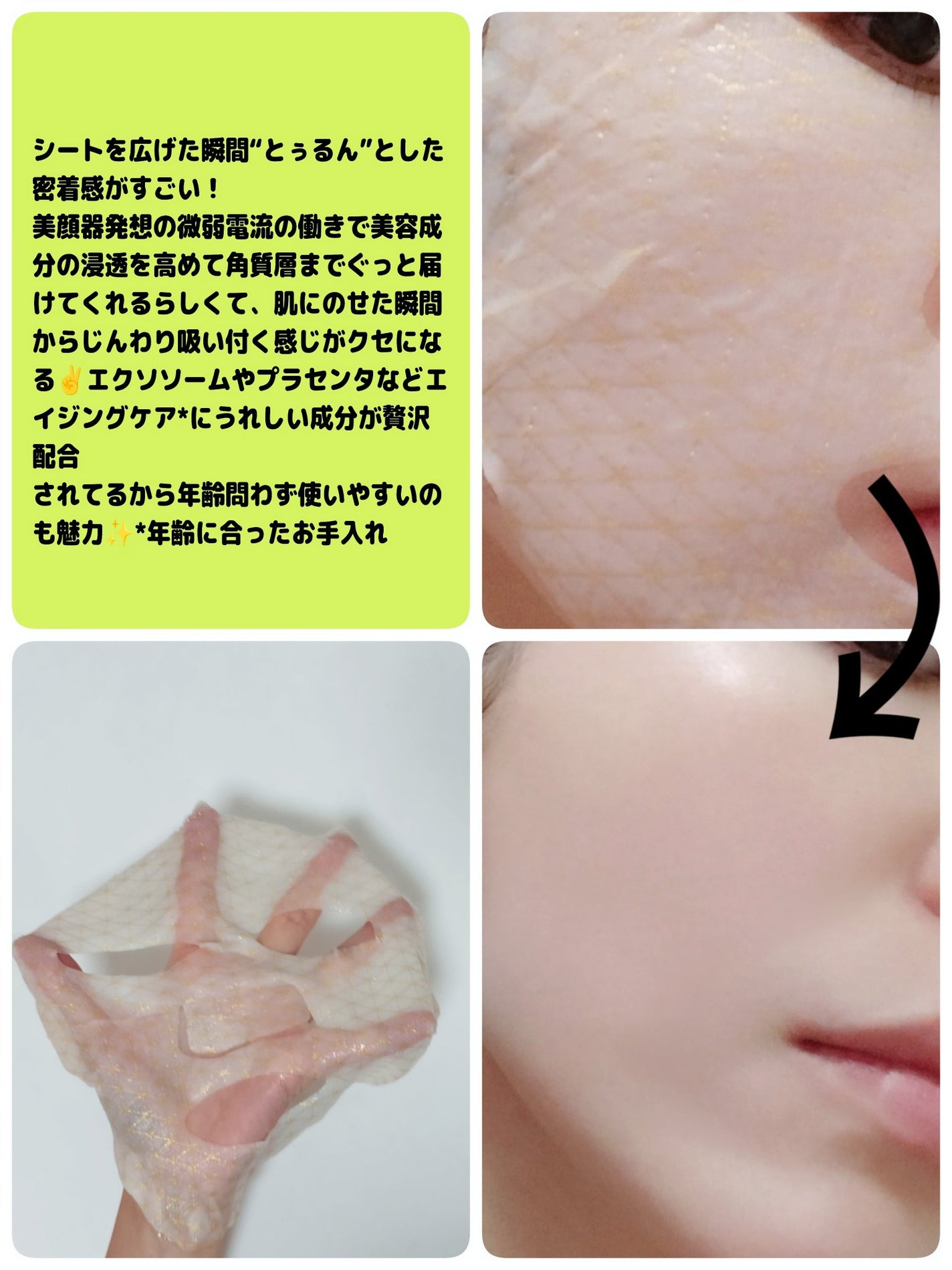 ゆきな on LIPS 「GENiSInazumask週1〜2で集中ケアしてみて肌の調子..」(3枚目)