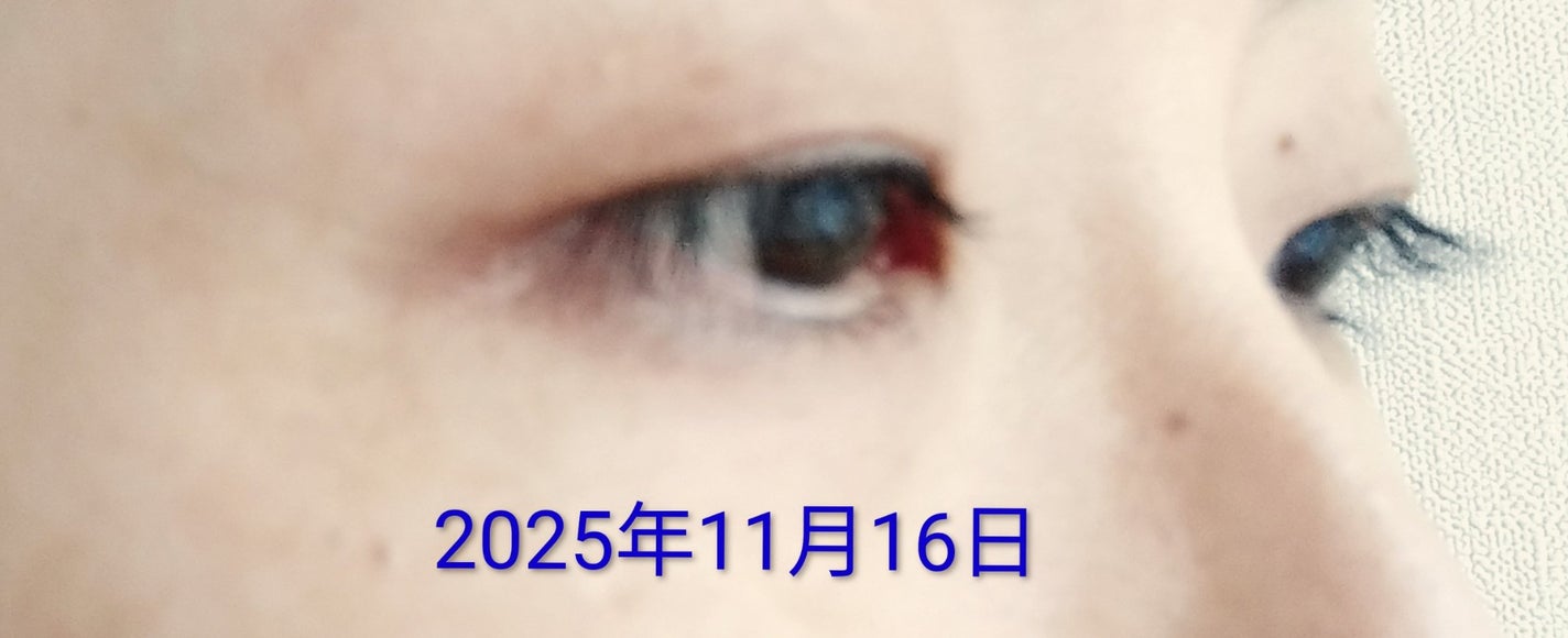 EMAKED(エマーキット)/水橋保寿堂製薬/まつげ美容液を使ったクチコミ(5枚目)