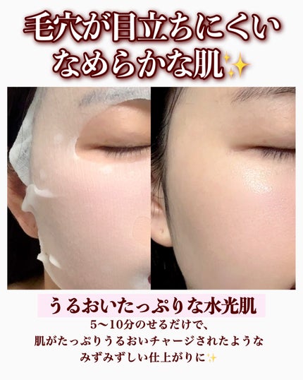 ルルルン ハイドラ V マスク/ルルルン/シートマスク・パックを使ったクチコミ(5枚目)