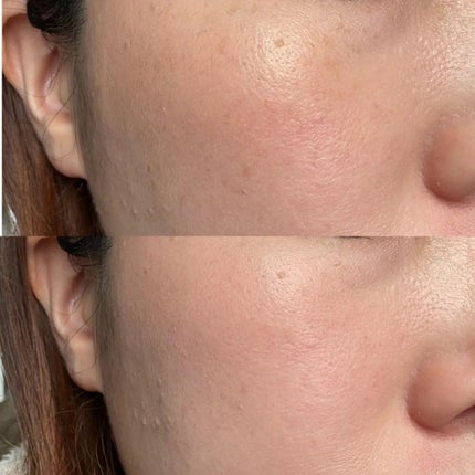 カモフラージュ コンシーラーチーク/ブリリアージュ/クリームコンシーラーを使ったクチコミ(4枚目)