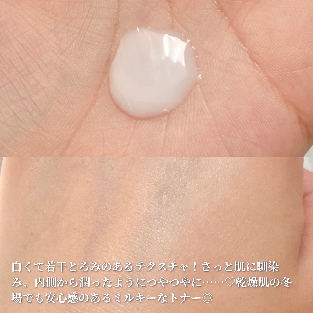 ダーマアンサーPDRNトナー/CNP Laboratory/化粧水を使ったクチコミ（2枚目）