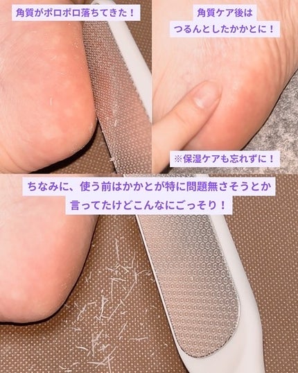 フットケアセット/BAREN/その他キットセットを使ったクチコミ(6枚目)