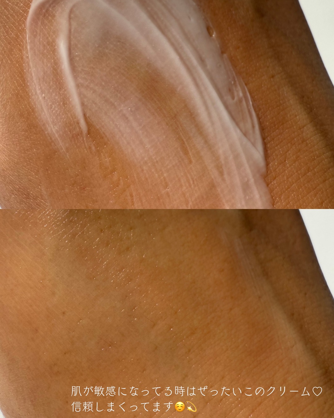 EPL キュアクリームXD/Dr.Oracle/フェイスクリームを使ったクチコミ（2枚目）