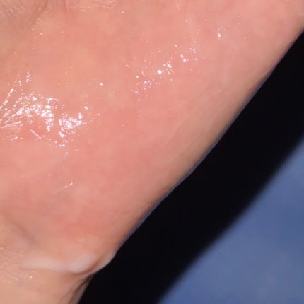 ブルービーンB5-PDRN™マイルドローション/BRING GREEN/乳液を使ったクチコミ(4枚目)