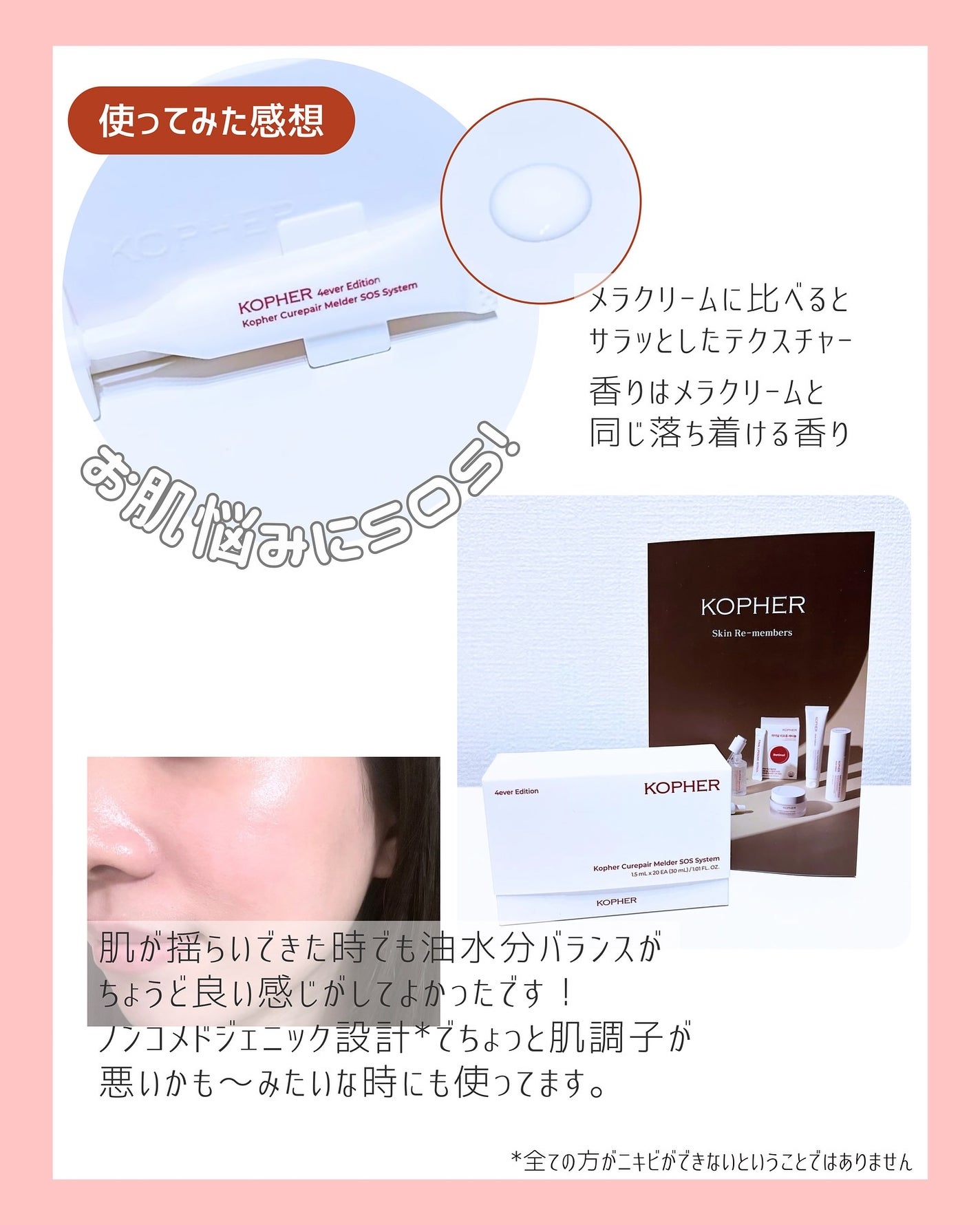 SOSメルダーシステム/KOPHER/フェイスクリームを使ったクチコミ(3枚目)
