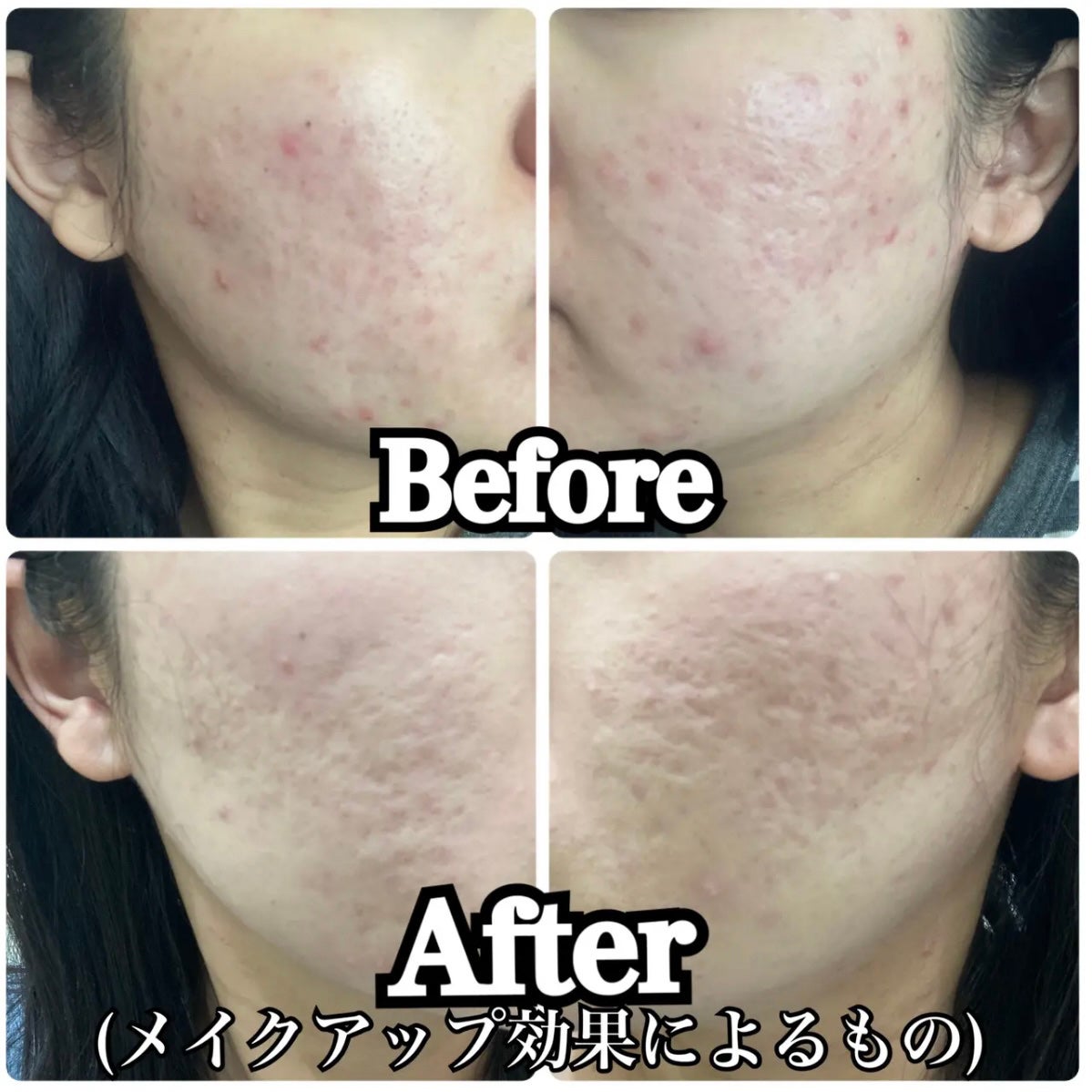 ソフトマットプレストパウダー/FUNNY ELVES方里/プレストパウダーを使ったクチコミ(5枚目)