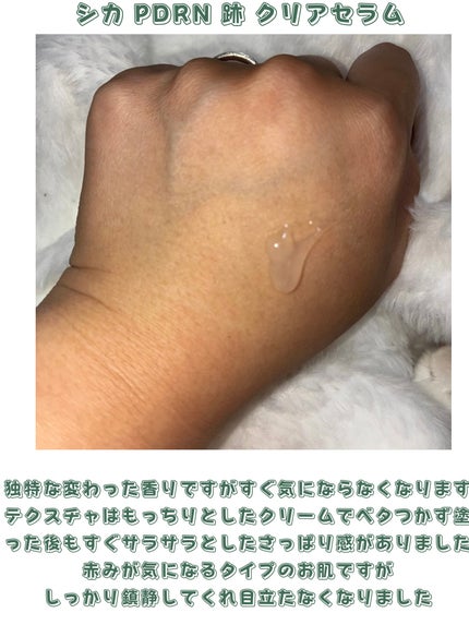 シカ PDRN 跡 クリアー トナーパッド/irecipe/トナーパッドを使ったクチコミ(4枚目)