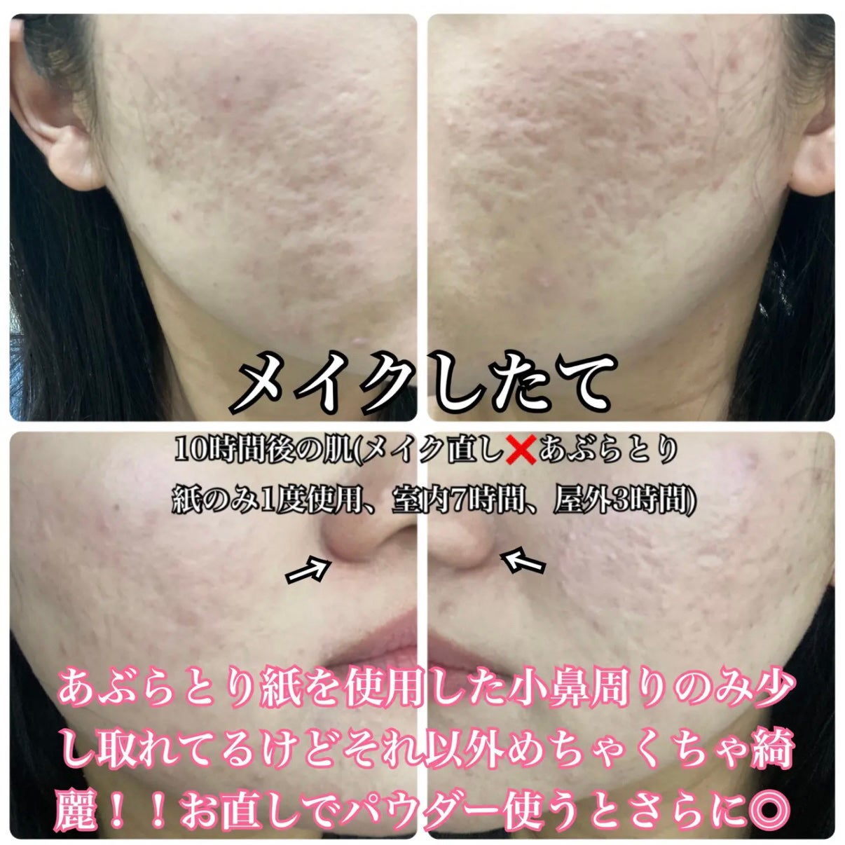 ソフトマットプレストパウダー/FUNNY ELVES方里/プレストパウダーを使ったクチコミ(6枚目)