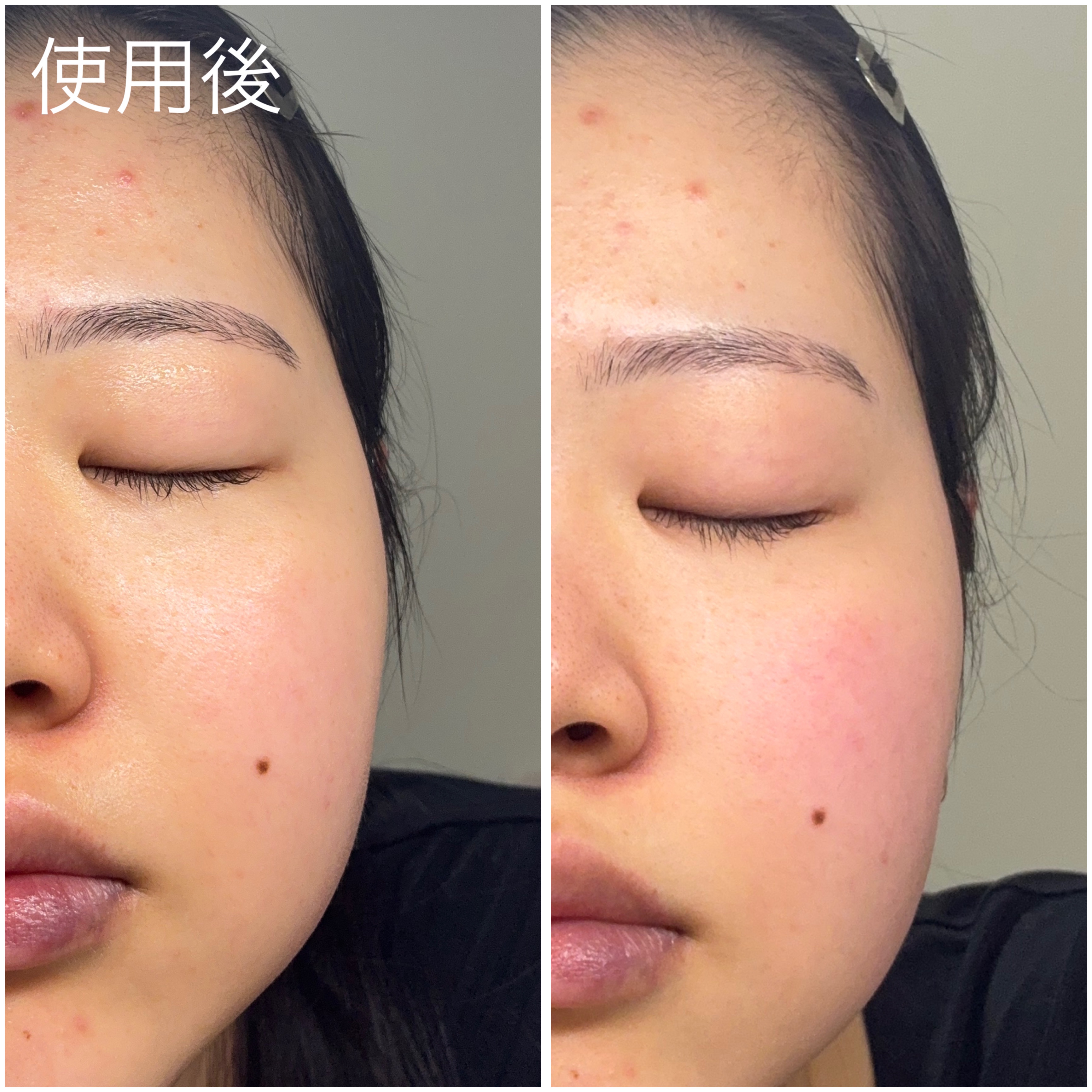 REJURAN ポアタイトニングトナーパッド 60枚入/REJURAN COSMETICS/トナーパッドを使ったクチコミ（2枚目）