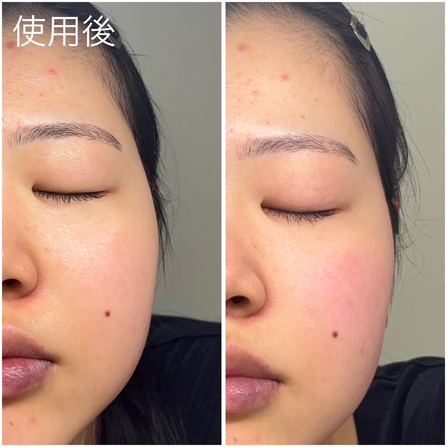 ポアタイトニングトナーパッド/REJURAN COSMETICS/トナーパッドを使ったクチコミ(2枚目)