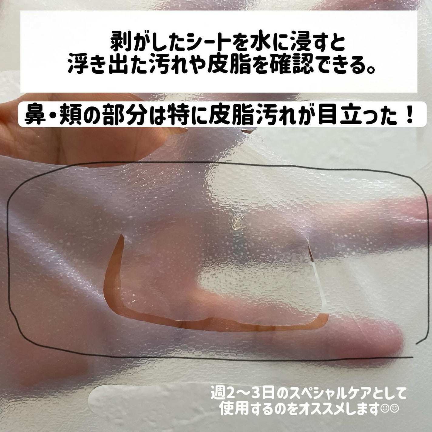 トラブルパッチマスク/EIOM/その他スキンケアを使ったクチコミ(4枚目)