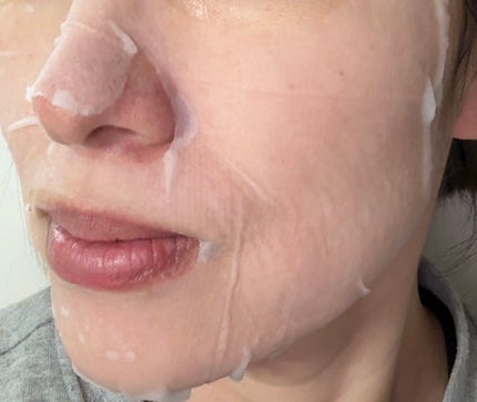 復活草シートマスクデイリーピック/Abib /シートマスク・パックを使ったクチコミ(4枚目)