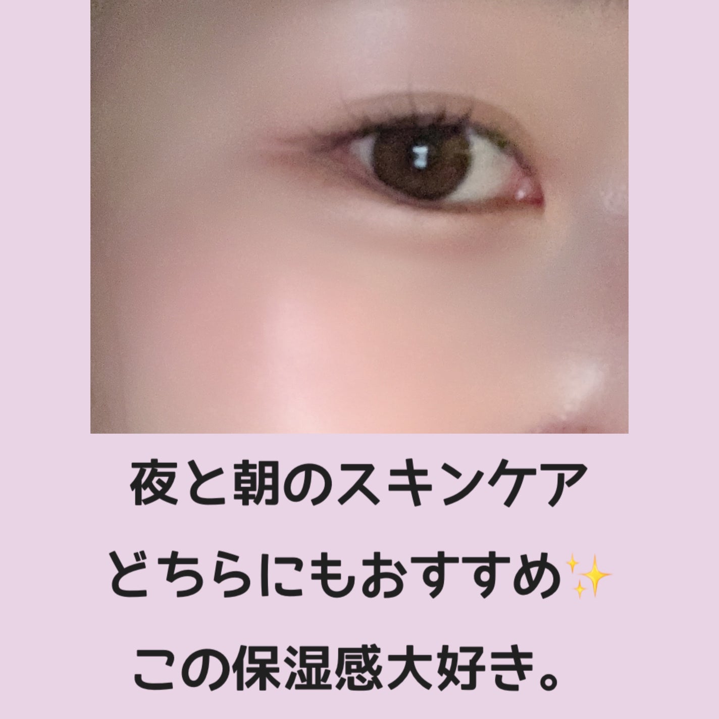 ブルービーンB5-PDRN™マイルドローション/BRING GREEN/乳液を使ったクチコミ(2枚目)