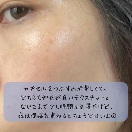 ブルービーンB5-PDRN™マイルドローション/BRING GREEN/乳液を使ったクチコミ(4枚目)