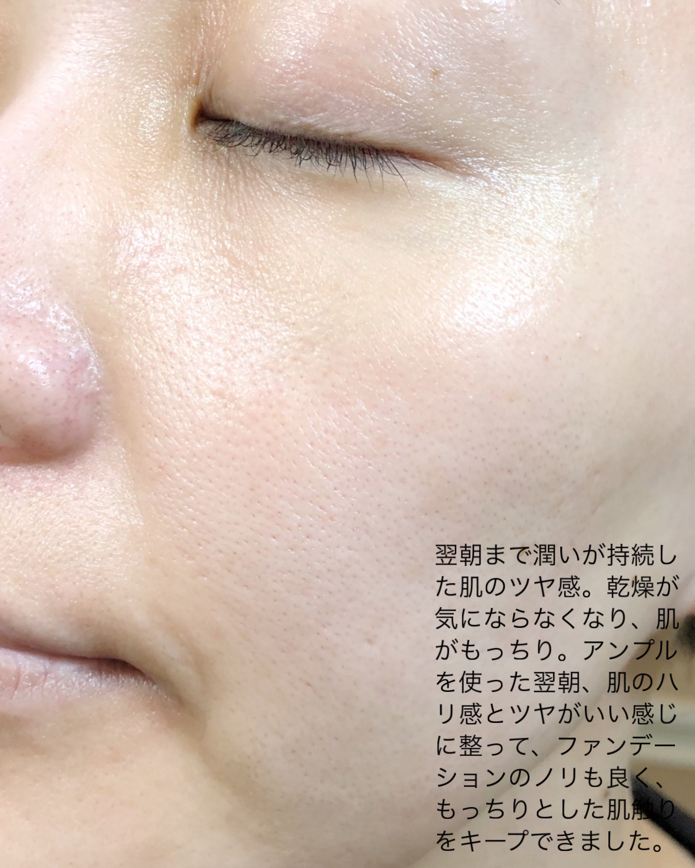 REJURAN デュアル エフェクト アンプル 30mL/REJURAN COSMETICS/美容液を使ったクチコミ（3枚目）