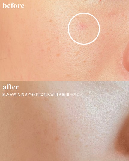 AZケア トナー/VT/化粧水を使ったクチコミ(3枚目)