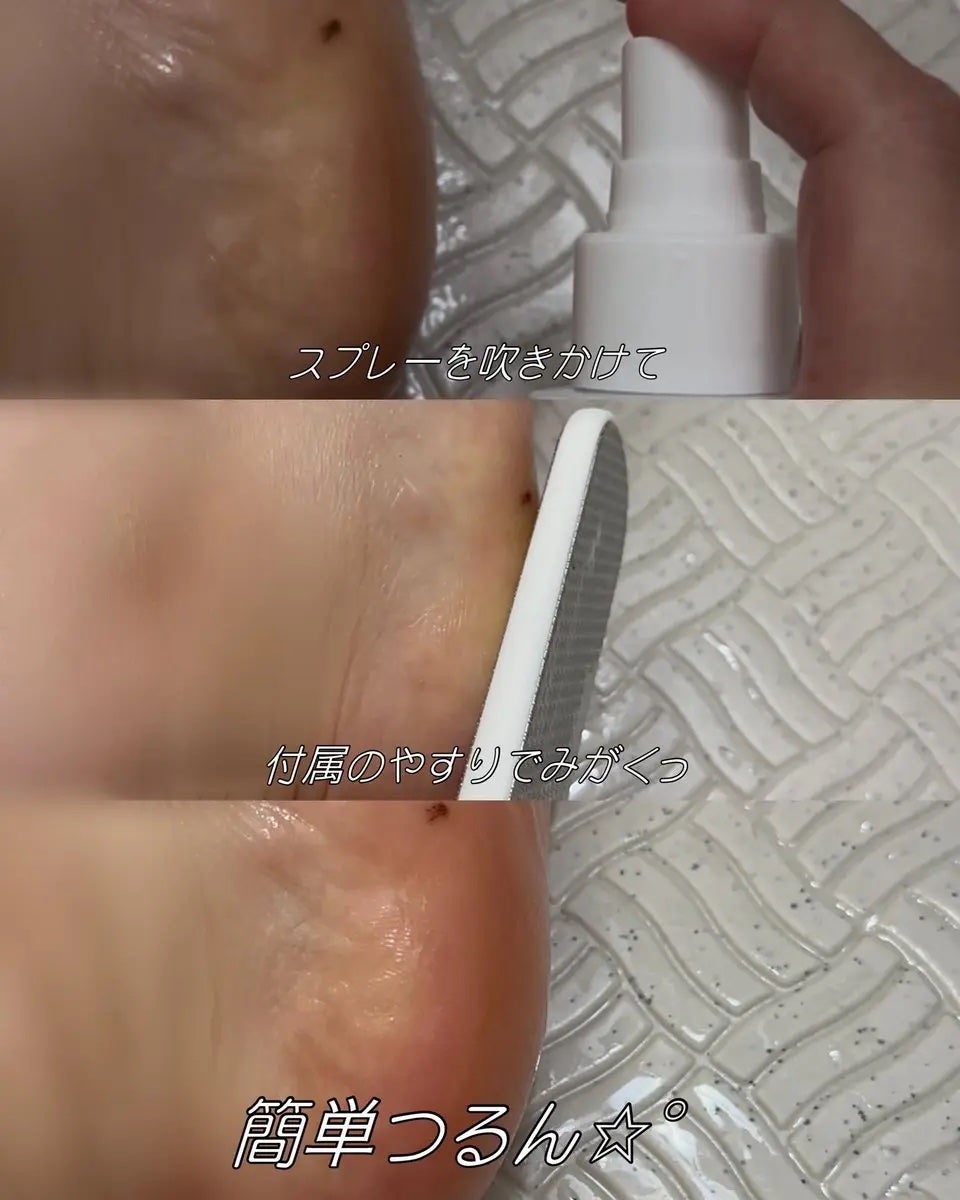 フットケアセット/BAREN/その他キットセットを使ったクチコミ(2枚目)