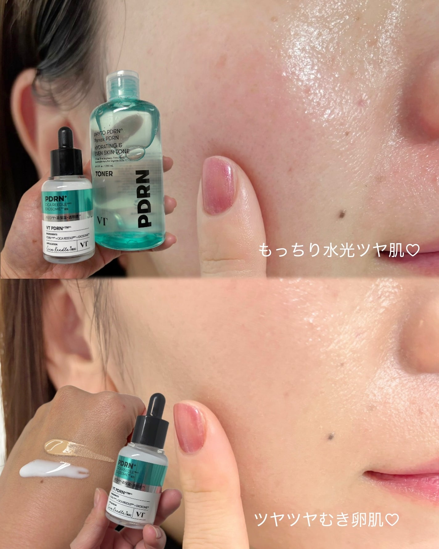 リードルS PDRN+ セラム/VT/美容液を使ったクチコミ(5枚目)