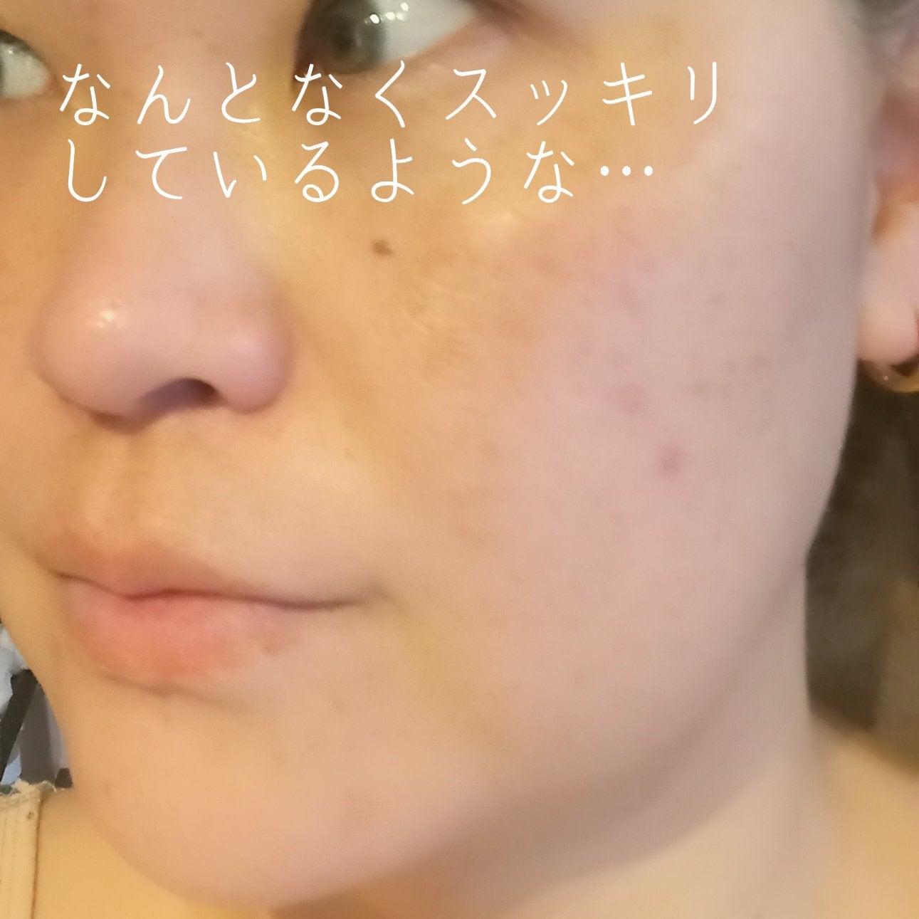 植物性ボトックスマスクパック/CHICSKIN/シートマスク・パックを使ったクチコミ(4枚目)