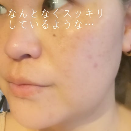 植物性ボトックスマスクパック/CHICSKIN/シートマスク・パックを使ったクチコミ(4枚目)