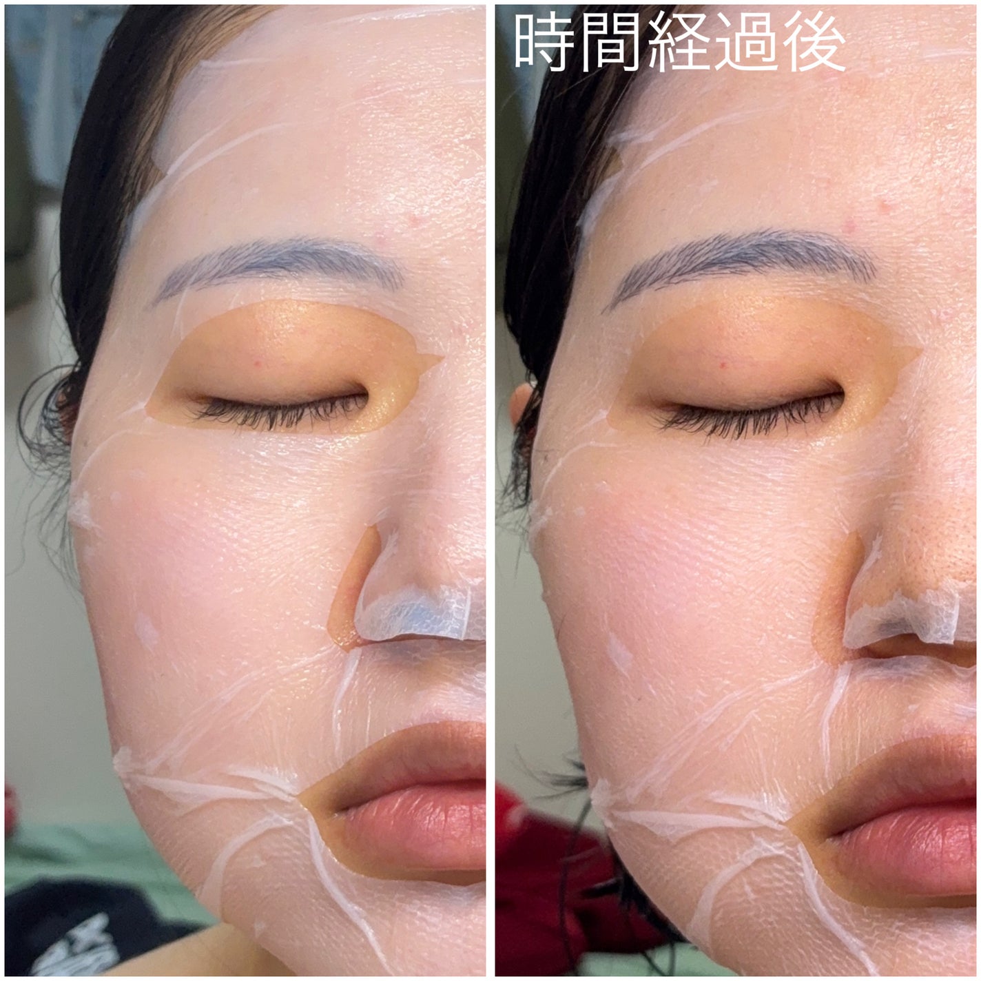 トラブルパッチマスク/EIOM/その他スキンケアを使ったクチコミ(3枚目)