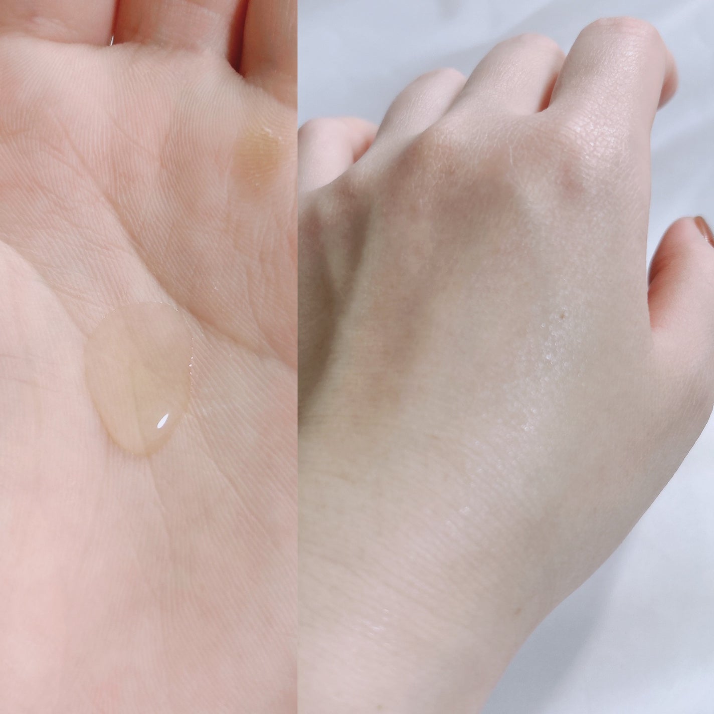 VC15特濃美容液/ケアナボーテ/美容液を使ったクチコミ(3枚目)