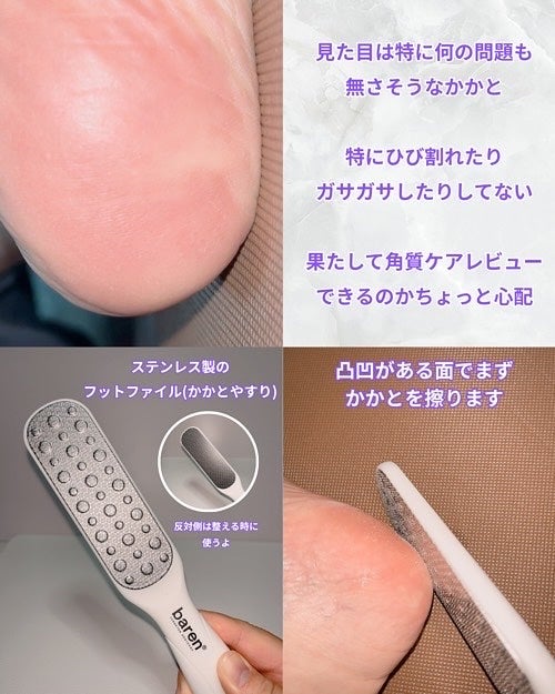 フットケアセット/BAREN/その他キットセットを使ったクチコミ(3枚目)