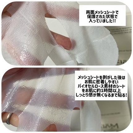 トラブルパッチマスク/EIOM/その他スキンケアを使ったクチコミ(3枚目)