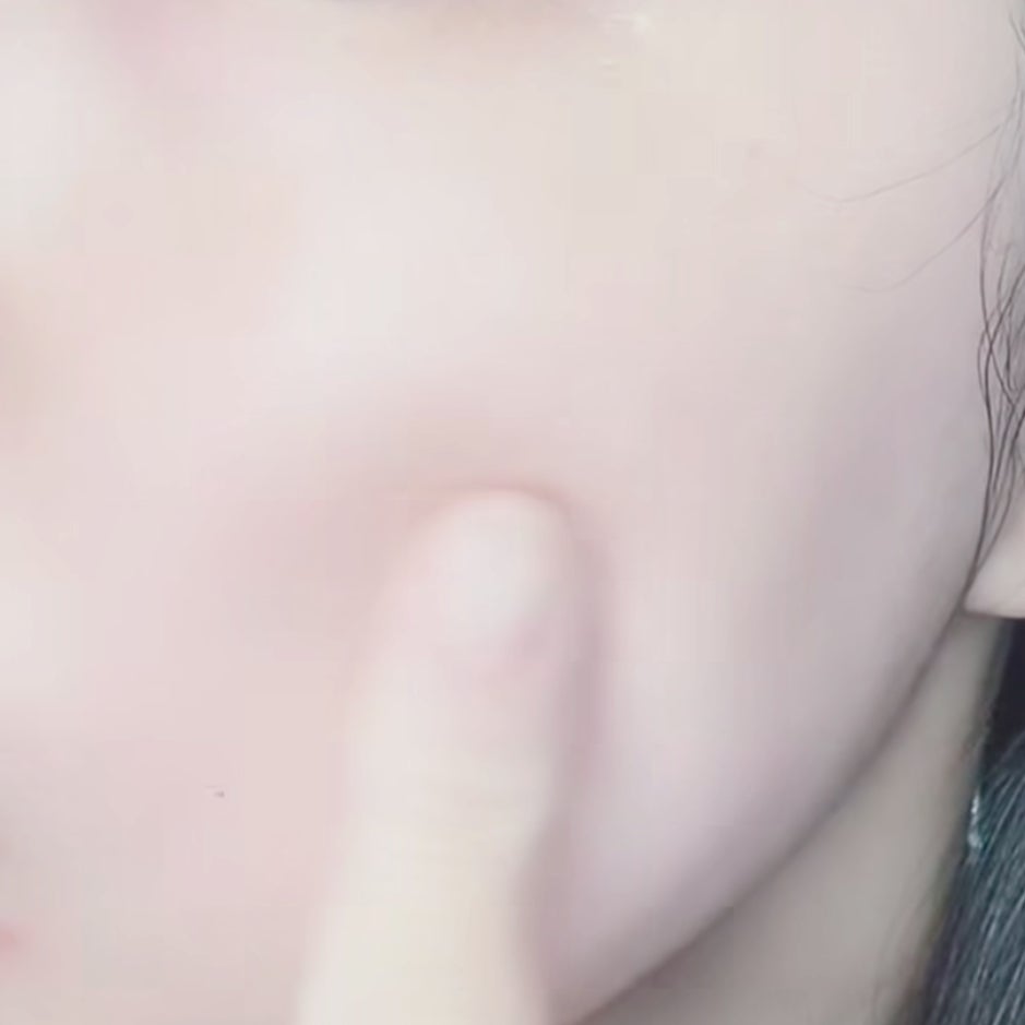 トラブルパッチマスク/EIOM/その他スキンケアを使ったクチコミ(3枚目)