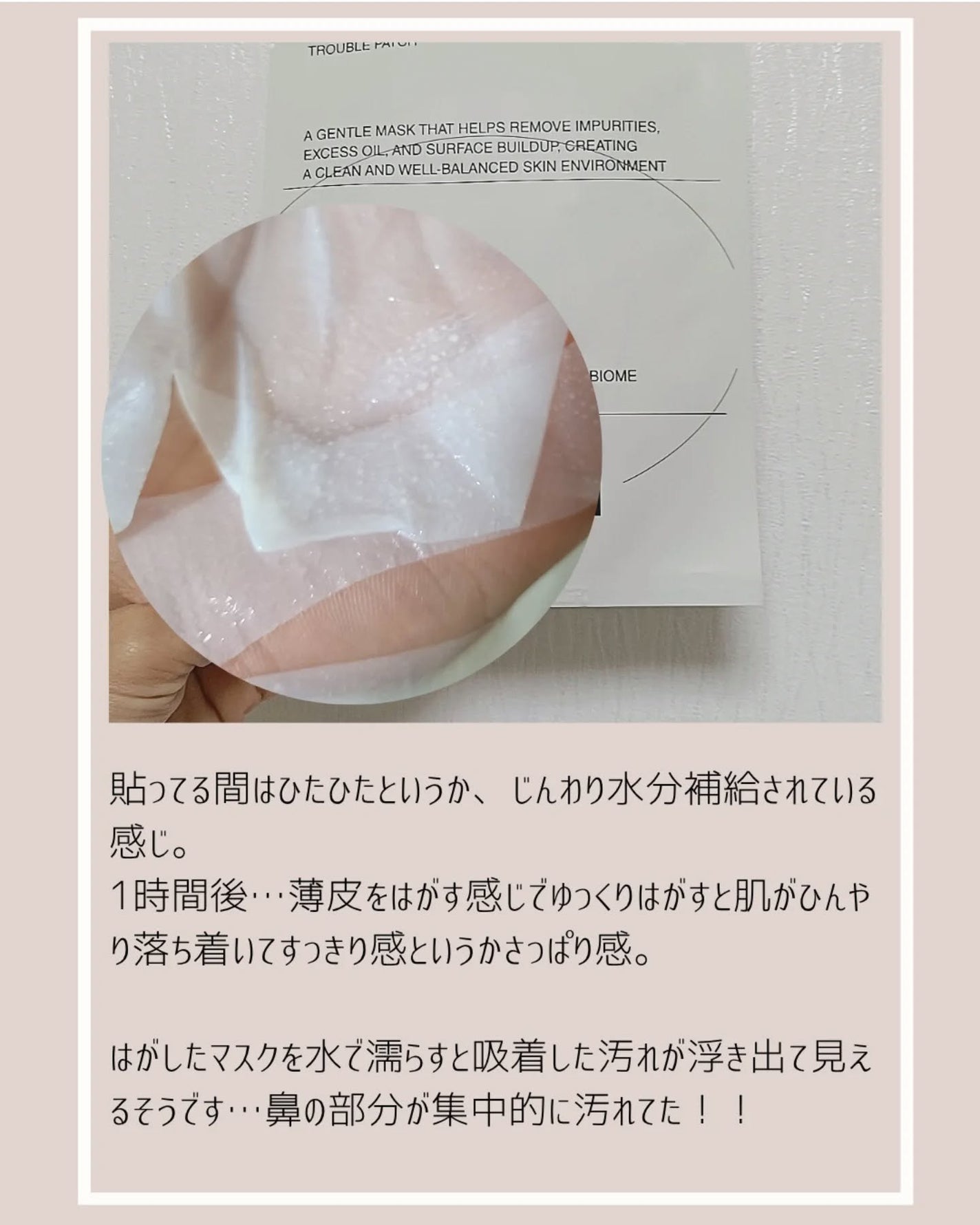 トラブルパッチマスク/EIOM/その他スキンケアを使ったクチコミ(4枚目)