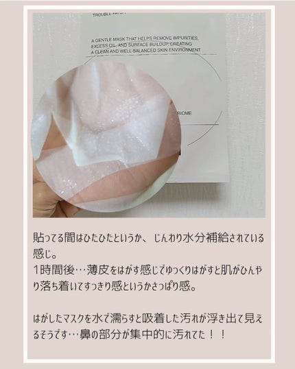 トラブルパッチマスク/EIOM/その他スキンケアを使ったクチコミ(4枚目)