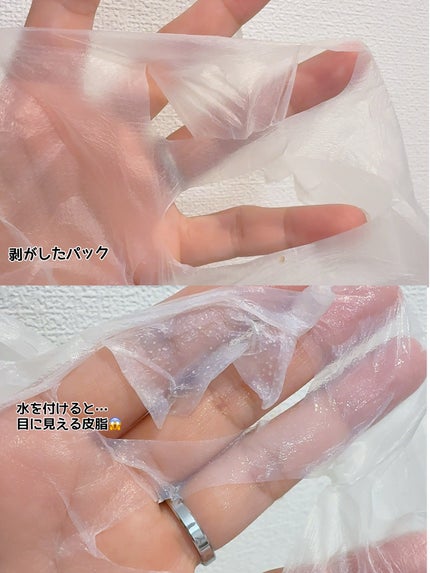 トラブルパッチマスク/EIOM/その他スキンケアを使ったクチコミ(4枚目)