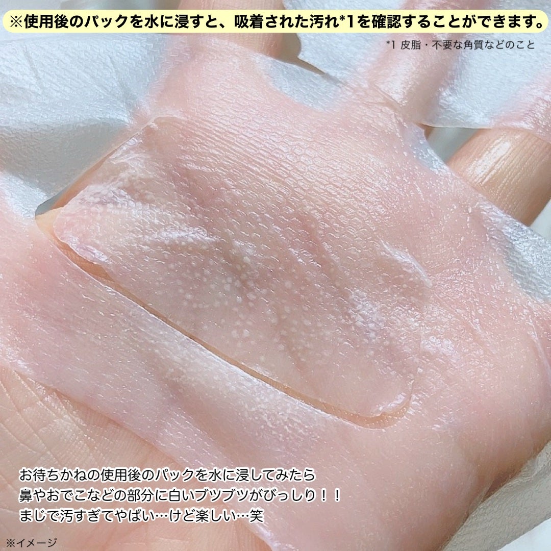 トラブルパッチマスク/EIOM/その他スキンケアを使ったクチコミ(6枚目)