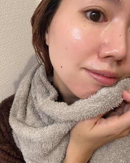 エアバブルCDSマスクP MELAゼロ/GASH/洗い流すパック・マスクを使ったクチコミ(6枚目)