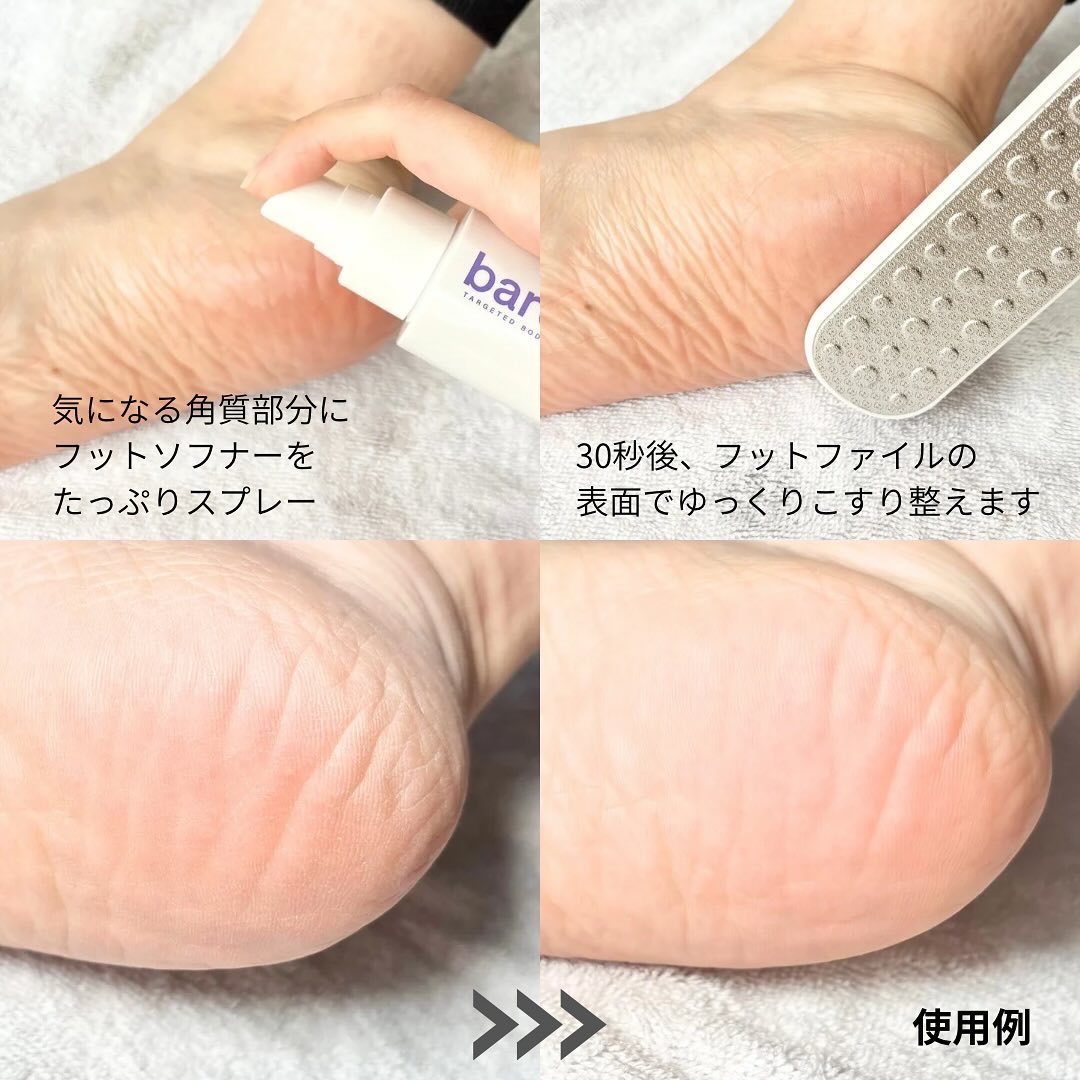 フットケアセット/BAREN/その他キットセットを使ったクチコミ（3枚目）